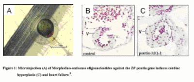 Fig. 1 Microinjection (A) of Morpholino antisense oligonucleotides against the zebrafish pontin gene induces cardiac hyperplasia (C) and heart failure.