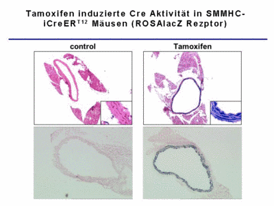 Abb. 4 Tamoxifen induzierte Cre Aktivität in SMMHC-iCreERT2 Mäusen (ROSAlacZ Reporter).