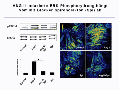 Abb. 3 Ang II induzierte ERK Phosphorylierung hängt vom MR Blocker Spironolakton (Spi) ab.
