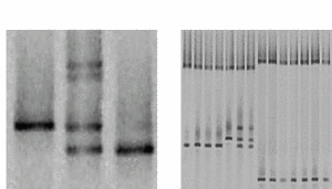 Fig. 1: Workflow of the mutation screening platform - PCR of exons and DGGE analysis