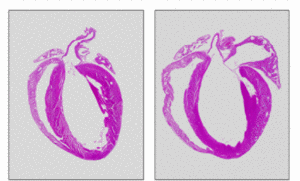 Fig. 1:	Calsarcin-deficient mouse heart (right), displaying dilated cardiomyopathy in response to aortic banding. A wildtype heart (left) subjected to banding served as control.
