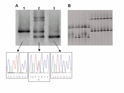 Fig 2: Representative DGGE results